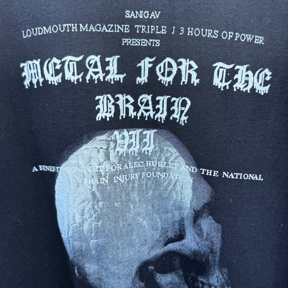 Metal For The Brain